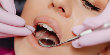 Preventive Dentistry Is Key To Preserving Natural Teeth