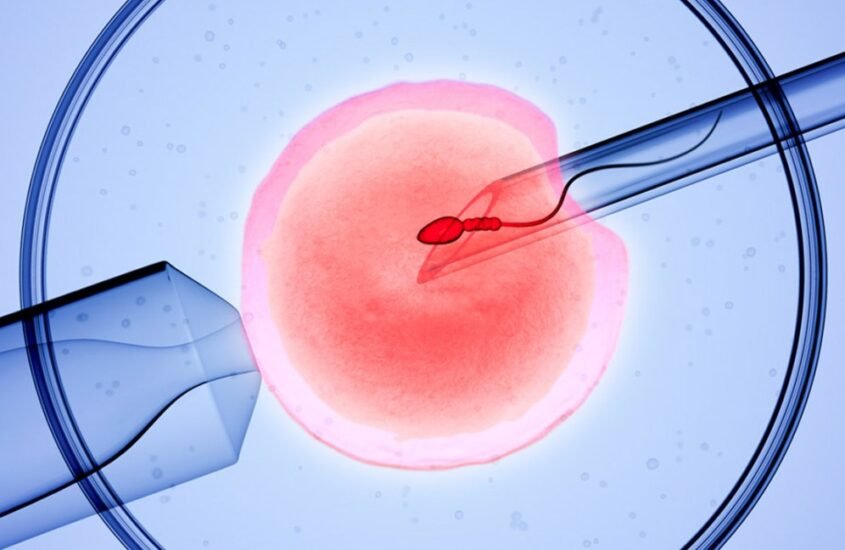 IVF care