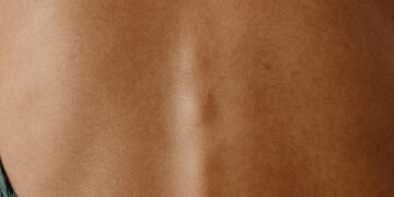 New Jersey Spine Specialists