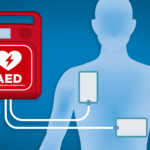 AED Defibrillators