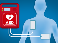AED Defibrillators