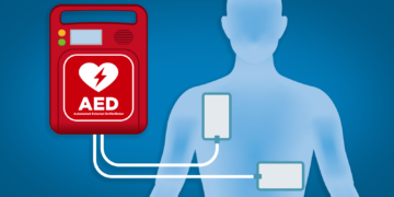 AED Defibrillators