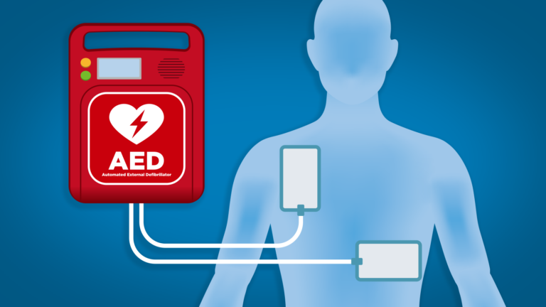 AED Defibrillators