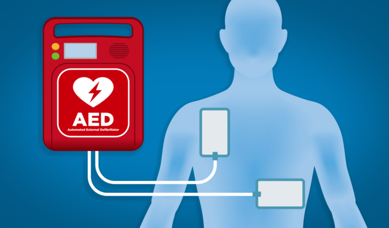 Why AED Defibrillators Are Becoming Essential Public Health Infrastructure: A Health Blogger’s Perspective on Kuteras Teknoloji, Automatic Defibrillators, and OEM Defibrillator Modules