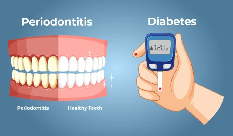 Why Periodontics Is Essential For Patients With Diabetes