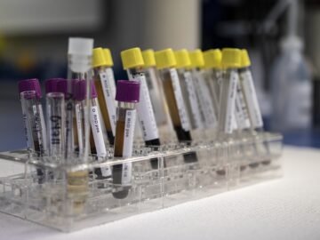 Essential Diagnostic Tests