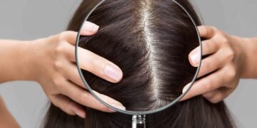 Scalp Health