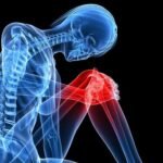 Achy Joints