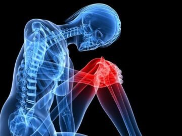Achy Joints