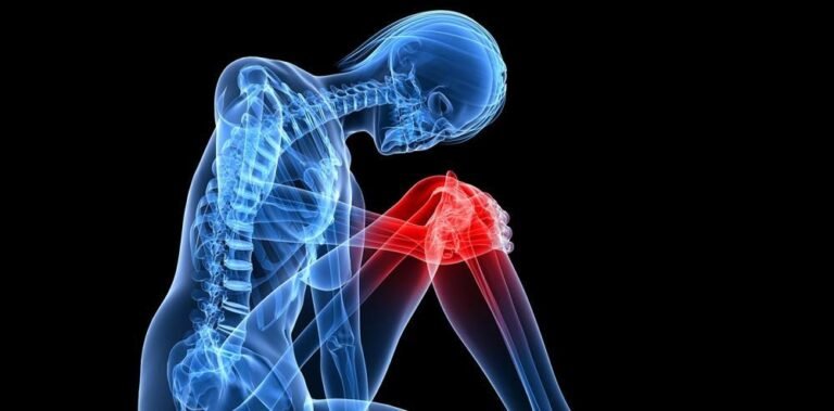 Achy Joints