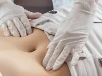 Treating a Hernia