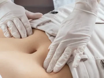 Treating a Hernia