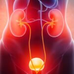UTI Treatment