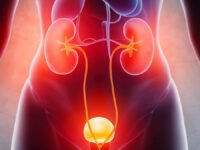 UTI Treatment