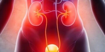 UTI Treatment
