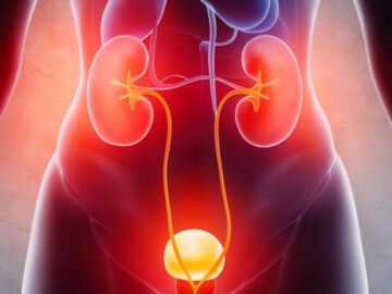 UTI Treatment
