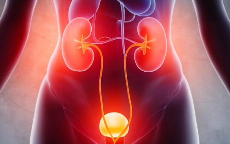 UTI Treatment