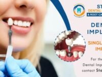 Dental Implants