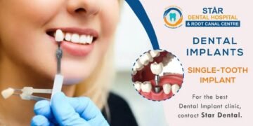 Dental Implants