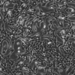VERO Cells