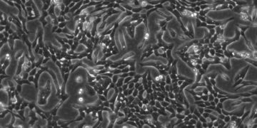 VERO Cells
