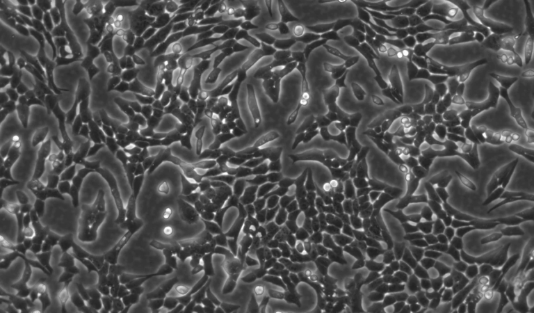 Why VERO Cells Remain the Gold Standard for Viral Research