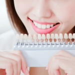 Cosmetic Treatments