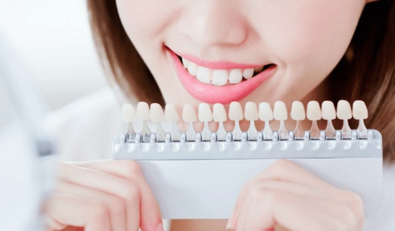 6 Common Cosmetic Treatments Offered In General Dental Practices