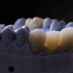 Bioceramics