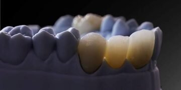 Bioceramics
