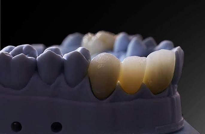 Bioceramics