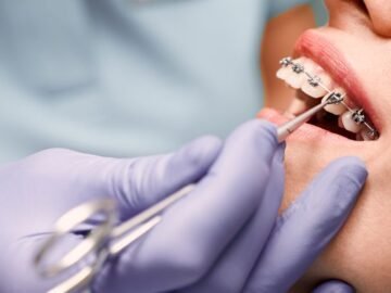 Orthodontists