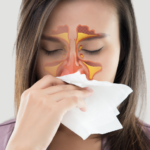 Recurring Sinus Infections