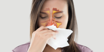 Recurring Sinus Infections