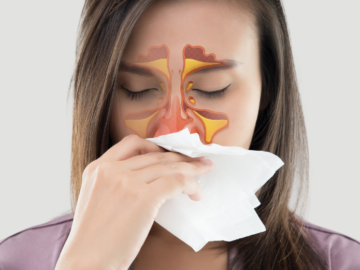 Recurring Sinus Infections