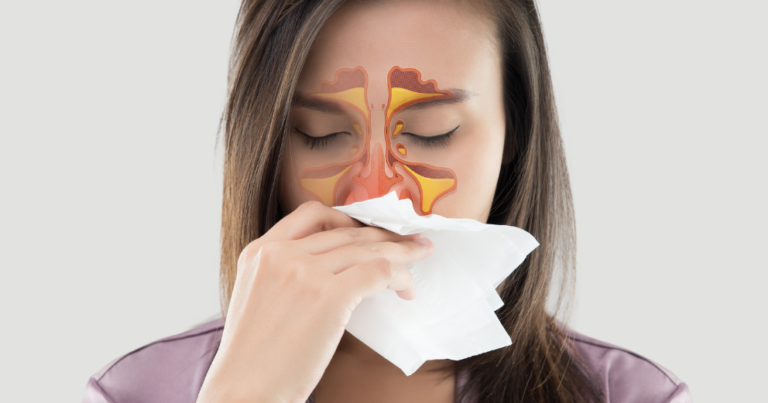 Recurring Sinus Infections