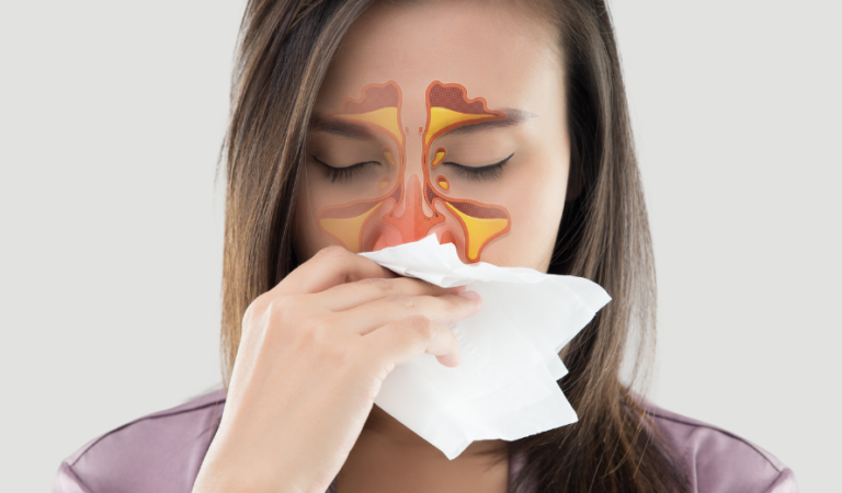 What Causes Recurring Sinus Infections in Some Adults