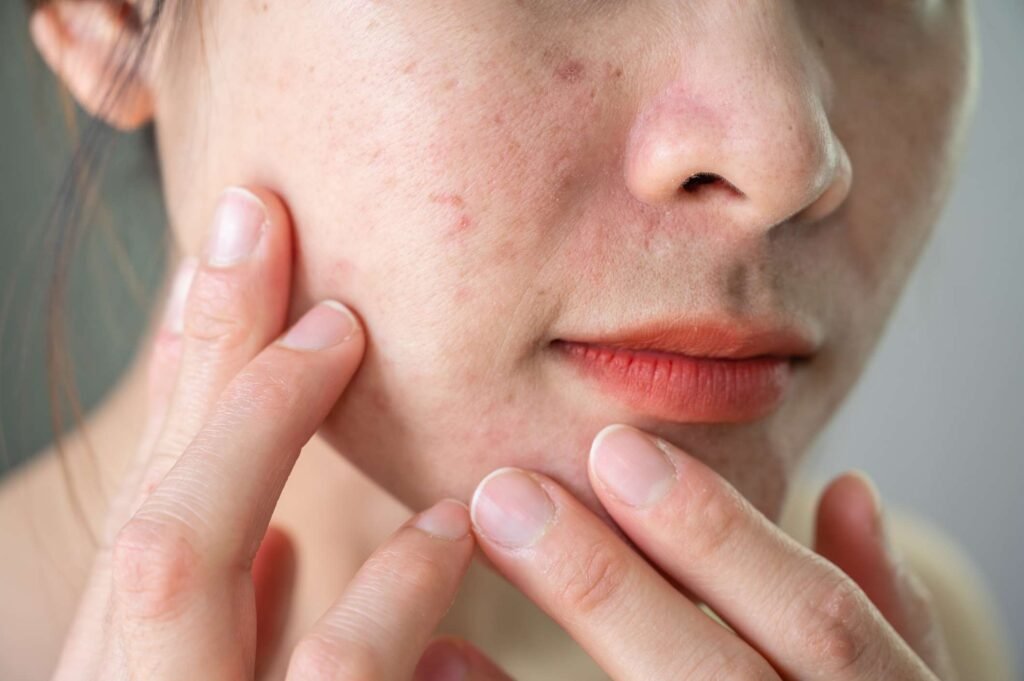 Facial Treatments for Uneven Skin Texture
