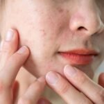 Facial Treatments for Uneven Skin Texture