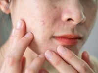 Facial Treatments for Uneven Skin Texture