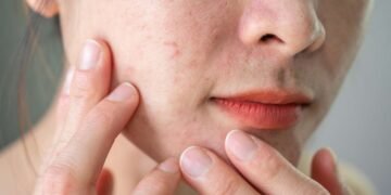 Facial Treatments for Uneven Skin Texture