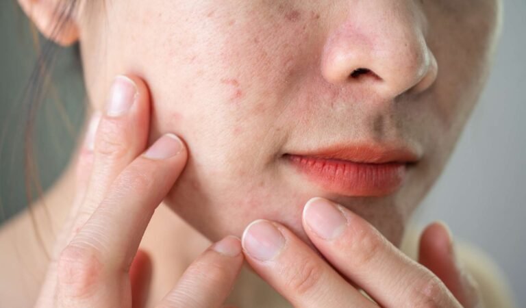 Facial Treatments for Uneven Skin Texture: How to Get Smoother Skin?