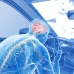 Traumatic Brain Injury After an Accident