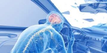 Traumatic Brain Injury After an Accident