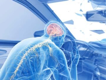 Traumatic Brain Injury After an Accident