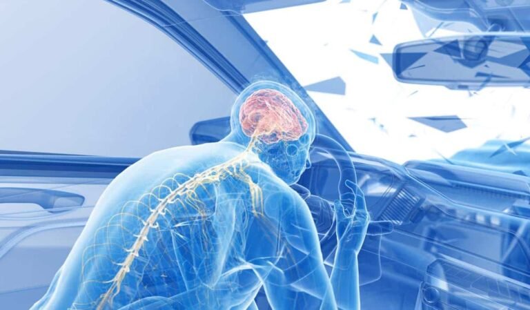 Traumatic Brain Injury After an Accident