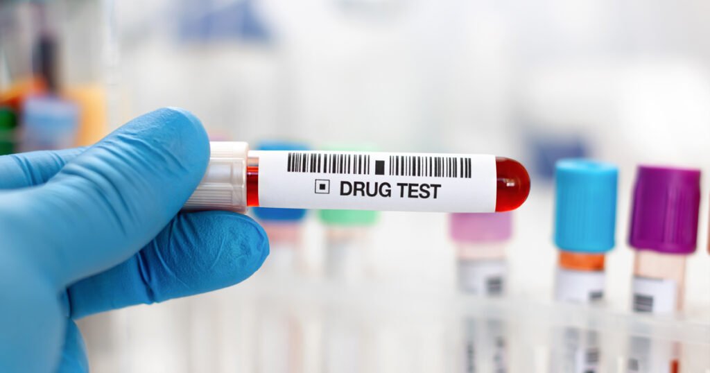 drug testing