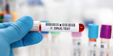drug testing