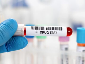 drug testing