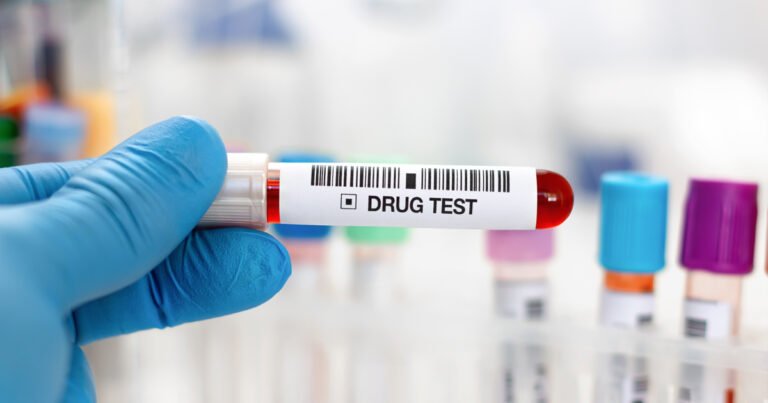 drug testing